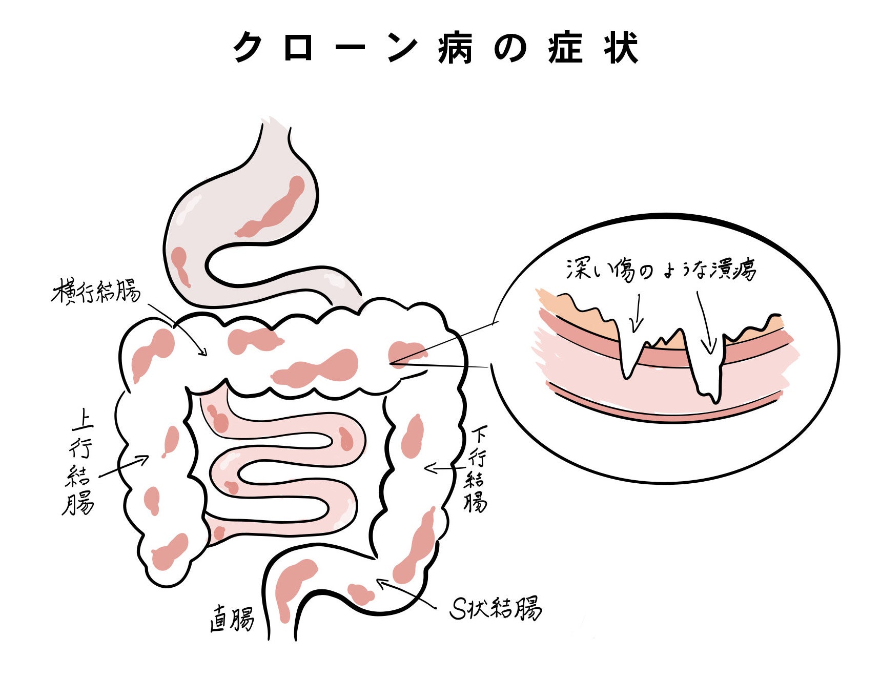 クローン病、潰瘍性大腸炎の患者の方に向けリビングのように過ごせるレストルーム「Premium T」をリリース。個人のお客様に向け、無償提供キャンペーンを開始。のサブ画像4